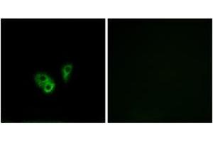 Immunofluorescence analysis of A549 cells, using CNGA2 Antibody. (CNGA2 抗体  (AA 391-440))