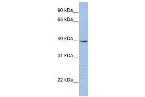 WB Suggested Anti-ZNF202  Antibody Titration: 0. (ZNF202 抗体  (N-Term))