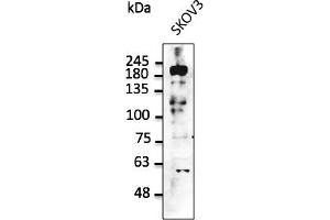 Western Blotting (WB) image for anti-Receptor tyrosine-protein kinase erbB-2 (ErbB2/Her2) (C-Term) antibody (ABIN6254225) (ErbB2/Her2 抗体  (C-Term))