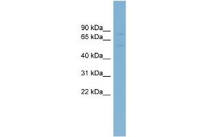 Western Blotting (WB) image for anti-ATP-Binding Cassette, Sub-Family G (WHITE), Member 5 (ABCG5) (Middle Region) antibody (ABIN2781532)