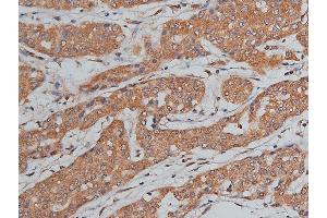 Immunohistochemistry (IHC) image for anti-Bone Morphogenetic Protein 3 (BMP3) (Internal Region) antibody (ABIN6260282)