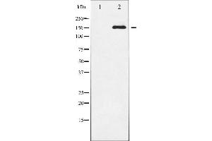 Western blot analysis of VEGFR2 phosphorylation expression in SK-OV3 whole cell lysates,The lane on the left is treated with the antigen-specific peptide. (VEGFR2/CD309 抗体  (pTyr951))