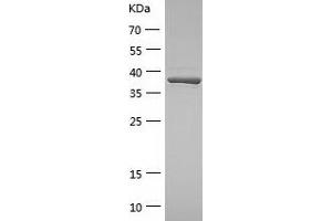 METAP1 Protein (AA 1-386) (His tag)