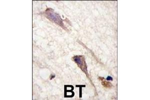 Formalin-fixed and paraffin-embedded human brain tissue reacted with BRAF Antibody  j , which was peroxidase-conjugated to the secondary antibody, followed by DAB staining. (SNRPE 抗体  (AA 580-609))