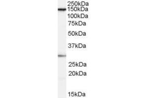 Western Blotting (WB) image for anti-FACT complex subunit SPT16 (SUPT16H) (Internal Region) antibody (ABIN2466335) (SUPT16H 抗体  (Internal Region))