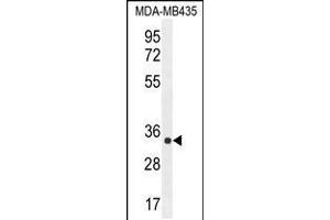 Western blot analysis in MDA-MB435 cell line lysates (35ug/lane). (ALKBH6 抗体  (AA 116-145))