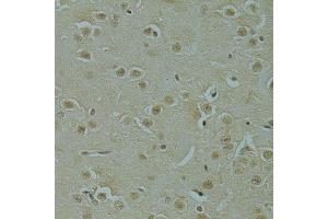 Immunohistochemistry (IHC) image for anti-arginine/serine-Rich Coiled-Coil 1 (RSRC1) (AA 117-276) antibody (ABIN6147283)