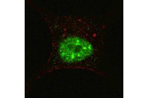 Fluorescent confocal image of SY5Y cells stained with phospho-STAT3- antibody. (STAT3 抗体  (pSer727))