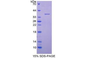 SDS-PAGE analysis of Human AQP1 Protein. (Aquaporin 1 蛋白)