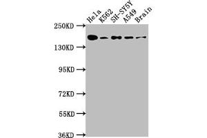 Western Blot Positive WB detected in: Hela whole cell lysate, K562 whole cell lysate, SH-SY5Y whole cell lysate, A549 whole cell lysate, Rat Brain whole cell lysate All lanes: APC antibody at 1:1000 Secondary Goat polyclonal to rabbit IgG at 1/50000 dilution Predicted band size: 312, 301, 309 kDa Observed band size: 160 kDa (Recombinant APC 抗体)