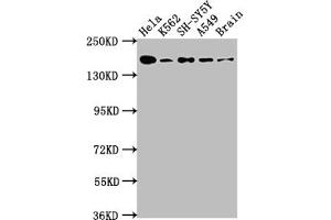 Western Blot Positive WB detected in: Hela whole cell lysate, K562 whole cell lysate, SH-SY5Y whole cell lysate, A549 whole cell lysate, Rat Brain whole cell lysate All lanes: APC antibody at 1:1000 Secondary Goat polyclonal to rabbit IgG at 1/50000 dilution Predicted band size: 312, 301, 309 kDa Observed band size: 160 kDa