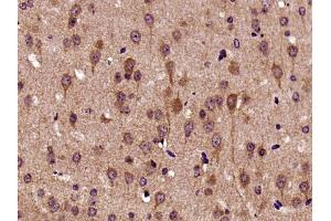 Paraformaldehyde-fixed, paraffin embedded mouse brain, Antigen retrieval by boiling in sodium citrate buffer (pH6) for 15min, Block endogenous peroxidase by 3% hydrogen peroxide for 30 minutes,  Blocking buffer (normal goat serum) at 37°C for 20min, Antibody incubation with Biglycan Polyclonal Antibody (bs-7552R) at 1:400 overnight at 4°C, followed by a conjugated secondary and DAB staining. (Biglycan 抗体  (AA 101-200))