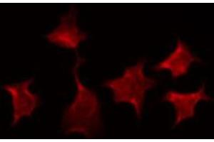 Immunofluorescence (fixed cells) (IF/ICC) image for anti-X-Ray Repair Complementing Defective Repair in Chinese Hamster Cells 3 (XRCC3) (N-Term) antibody (ABIN6266068)