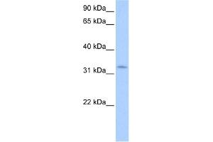 WB Suggested Anti-NRIP2 Antibody Titration:  0. (NRIP2 抗体  (N-Term))
