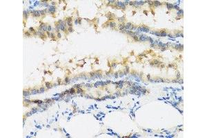 Immunohistochemistry of paraffin-embedded Mouse lung using IFNL3 Polyclonal Antibody at dilution of 1:100 (40x lens). (IL28B 抗体)