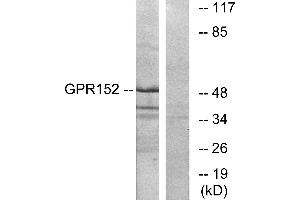 Western blot analysis of extracts from Jurkat cells, using GPR152 antibody. (GPR152 抗体  (N-Term))