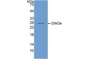 Western Blotting (WB) image for Cartilage Oligomeric Matrix Protein (COMP) ELISA Kit (ABIN6720567)
