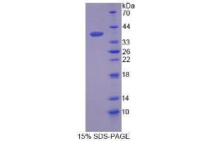 SDS-PAGE analysis of Human SCGB2A2 Protein. (Mammaglobin A 蛋白)