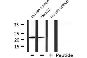 Western blot analysis of extracts from mouse spleen, HepG2, using DIRA1 Antibody.