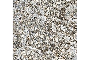 IHC analysis of Thioredoxin 2/TXN2 using anti-Thioredoxin 2/TXN2 antibody (ABIN7602149).