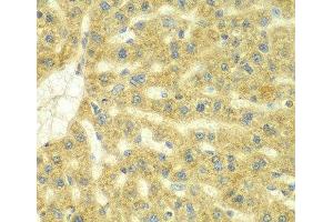 Immunohistochemistry of paraffin-embedded Rat liver using ADCK3 Polyclonal Antibody at dilution of 1:100 (40x lens). (COQ8A 抗体)