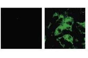 Immunofluorescence (IF) image for anti-SARS-Coronavirus Spike Protein (SARS-CoV S) antibody (ABIN2452119) (SARS-CoV Spike 抗体)