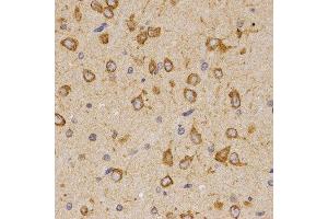 Immunohistochemistry of paraffin-embedded rat brain tissue using SCTR antibody at dilution of 1:200 (x400 lens) (SCTR 抗体)