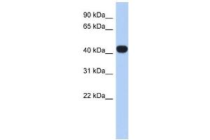 RASGEF1C antibody used at 1 ug/ml to detect target protein. (RASGEF1C 抗体  (N-Term))