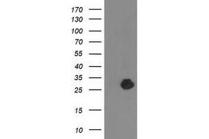 HEK293T cells were transfected with the pCMV6-ENTRY control (Left lane) or pCMV6-ENTRY ZFAND2B (Right lane) cDNA for 48 hrs and lysed. (ZFAND2B 抗体)