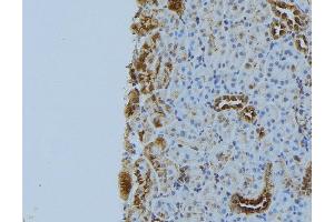 ABIN6272893 at 1/100 staining Mouse kidney tissue by IHC-P. (NBR1 抗体)