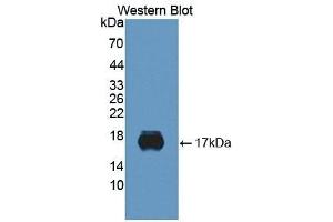 Detection of Recombinant SIGLEC10, Human using Monoclonal Antibody to Sialic Acid Binding Ig Like Lectin 10 (SIGLEC10)