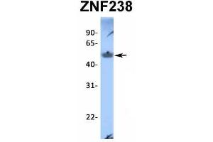 Western Blotting (WB) image for anti-Zinc Finger Protein 238 (ZNF238) (N-Term) antibody (ABIN2776459)