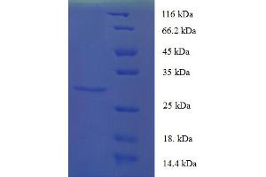 SDS-PAGE (SDS) image for CD82 (CD82) (AA 111-227), (Extracellular) protein (His-SUMO Tag) (ABIN5709253)