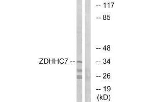 Western blot analysis of extracts from HUVEC cells, using ZDHHC7 antibody.