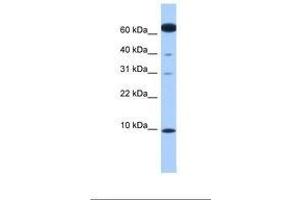 Image no. 1 for anti-Dynein, Light Chain, LC8-Type 1 (DYNLL1) (N-Term) antibody (ABIN6738836) (DYNLL1 抗体  (N-Term))