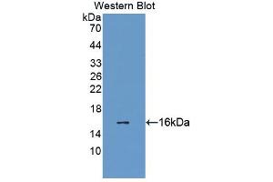 Western blot analysis of the recombinant protein. (LOXL2 抗体  (AA 434-546))