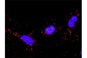 Proximity Ligation Analysis of protein-protein interactions between CRK and SOS1. (Crk 抗体  (AA 1-204))