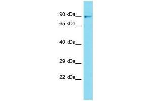 Western Blotting (WB) image for anti-Fibroblast Growth Factor Receptor 1 (FGFR1) (N-Term) antibody (ABIN2440842) (FGFR1 抗体  (N-Term))