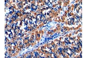 Detection of MCP1 in Human Stomach Tissue using Polyclonal Antibody to Monocyte Chemotactic Protein 1 (MCP1) (CCL2 抗体  (AA 24-99))
