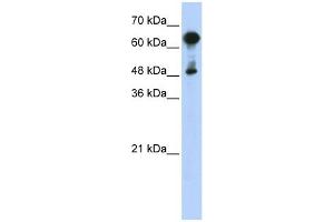 HSPA6 antibody used at 1 ug/ml to detect target protein. (HSPA6 抗体)