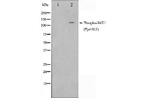 Western blot analysis of JAK1 phosphorylation expression in A549 whole cell lysates,The lane on the left is treated with the antigen-specific peptide. (JAK1 抗体  (pTyr1022, pTyr1023))