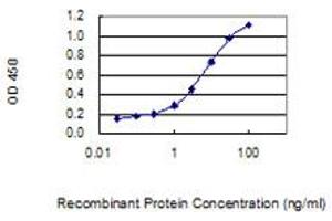 Detection limit for recombinant GST tagged WBSCR27 is 0. (WBSCR27 抗体  (AA 1-245))