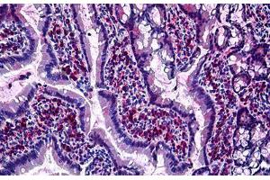 Rat Intestine: Formalin-Fixed, Paraffin-Embedded (FFPE) (GJB2 抗体  (Cytoplasmic Domain))