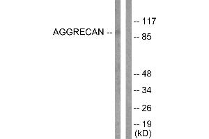 Western blot analysis of extracts from Jurkat cells, treated with Etoposide (25uM, 60mins), using Aggrecan (Cleaved-Asp369) antibody (#L0101). (Aggrecan 抗体  (Cleaved-Asp369))