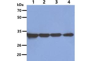 The Cell lysates (40ug) were resolved by SDS-PAGE, transferred to PVDF membrane and probed with anti-human OTUB1 antibody (1:5000). (OTUB1 抗体)
