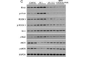 Fasudil protects HUVEC cells from H/R-induced apoptosis(A) MTT was used to determine the IC50 of FSD in HUVEC cells cultured in standard condition. (RHOA 抗体  (pSer188))