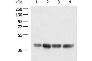 Western blot analysis of LOVO K562 Jurkat and Hela cell lysates using MRPS35 Polyclonal Antibody at dilution of 1:900 (MRPS35 抗体)