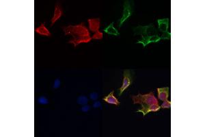 ABIN6259869 and ABIN6267009 staining Hela by IF/ICC. (AKT 1/2/3 抗体  (C-Term, pan))