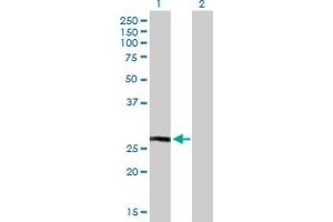 Western Blot analysis of HLA-DQB1 expression in transfected 293T cell line by HLA-DQB1 MaxPab polyclonal antibody. (HLA-DQB1 抗体  (AA 1-261))