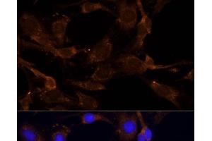 Immunofluorescence analysis of C6 cells using RPL27 Polyclonal Antibody at dilution of 1:100 (40x lens). (RPL27 抗体)